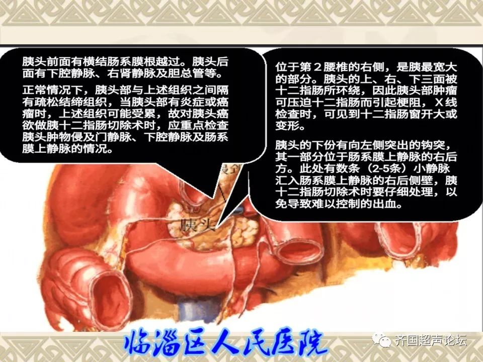 【临医超声学堂】胰腺的解剖