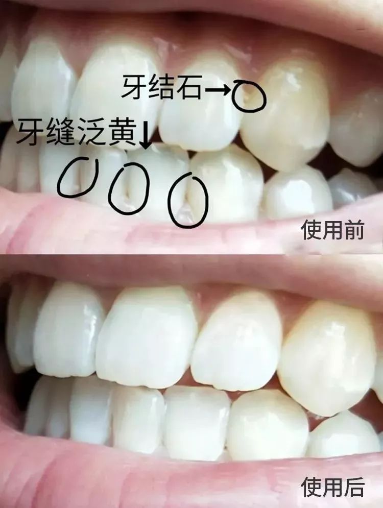                     校园霸凌？6岁男孩遭遇同学嘲笑欺压，原因让网友傻眼？