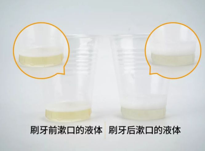                     校园霸凌？6岁男孩遭遇同学嘲笑欺压，原因让网友傻眼？