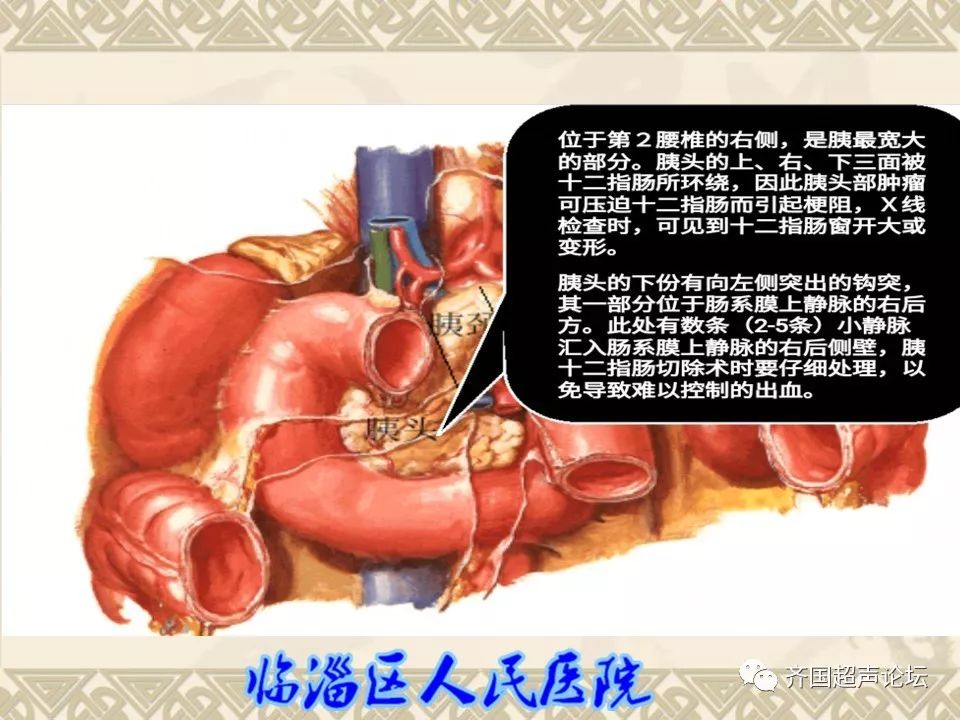 【临医超声学堂】胰腺的解剖