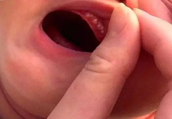                     月嫂总结那些被新手妈妈问过一万遍的问题