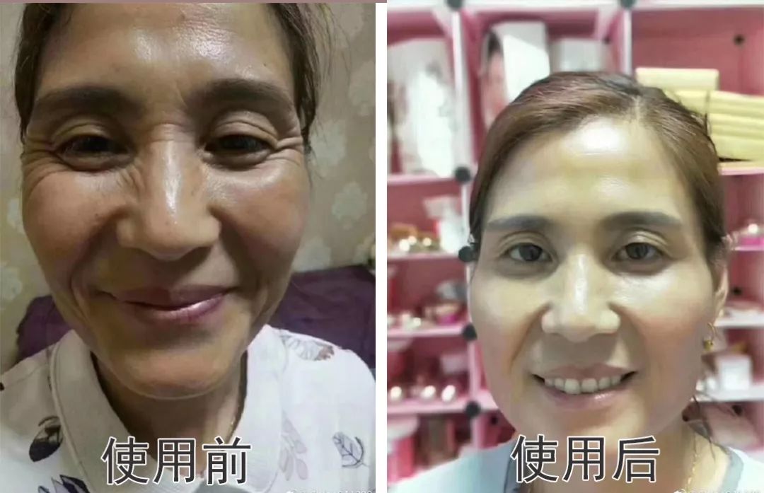 "变脸"比拼少女,只因抹了点它._皱纹