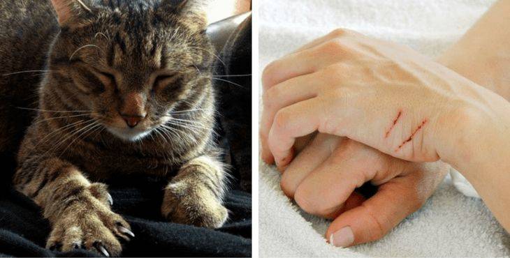 被猫抓了怎么办撸猫需谨慎猫抓病的症状以及如何治疗预防