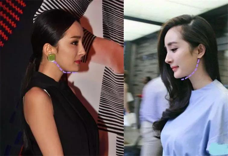 所以下颌骨的塑形其实也跟医美技术的发展与时代的审美有关.