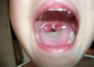                     万能消积方：孩子积食再严重，这碗黄金汤下肚，一口立消百试百灵