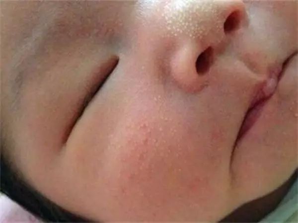                     月嫂总结那些被新手妈妈问过一万遍的问题