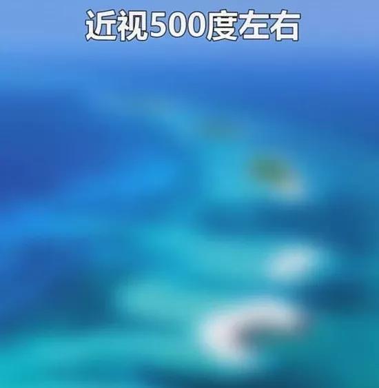 近视达到300-400度:这双眼睛下的世界,很多东西都会有重影.