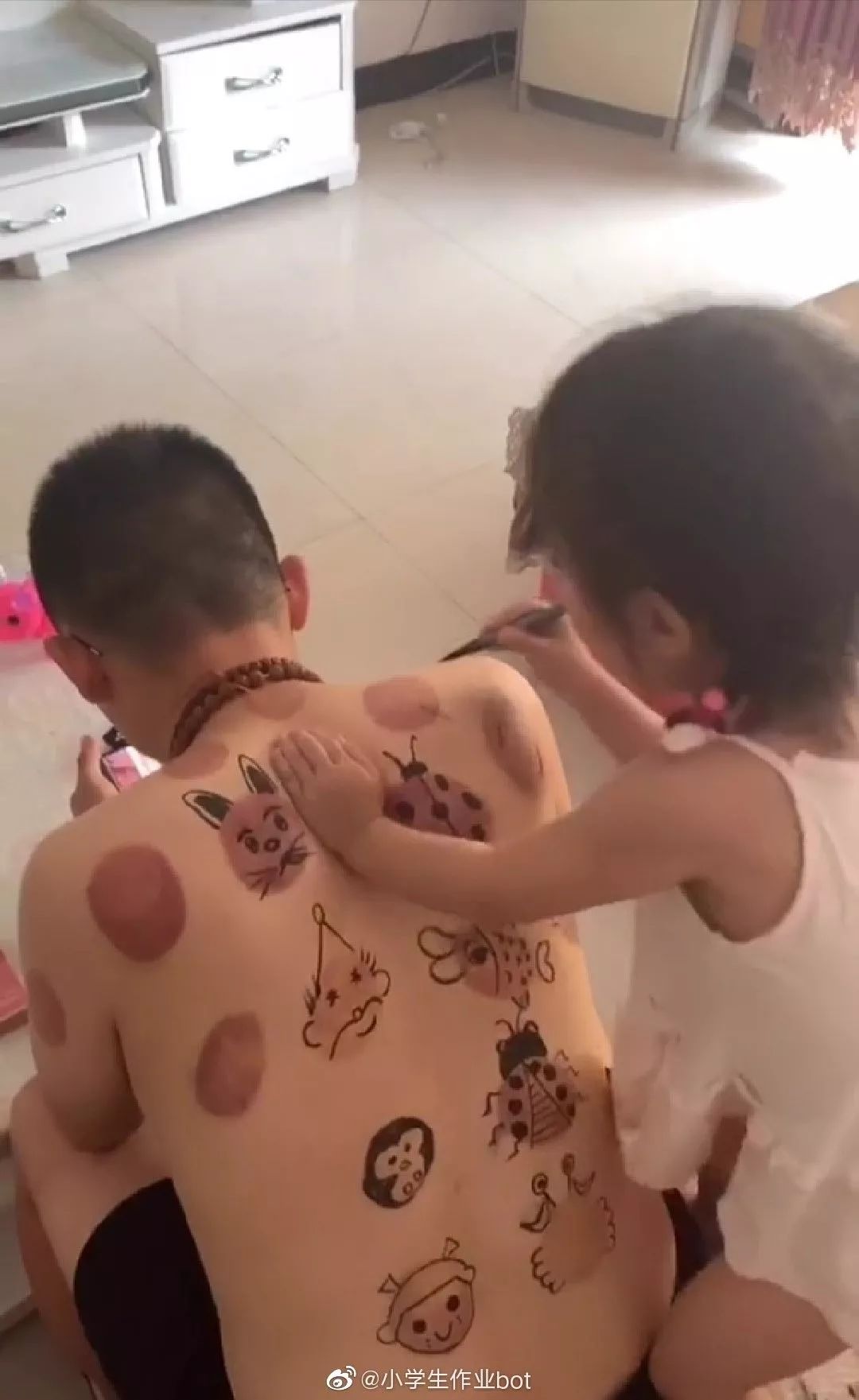 爸爸拔完火罐后的正确做法是……哈哈哈哈哈,莫名觉得有点儿可爱 大满贯mg电子