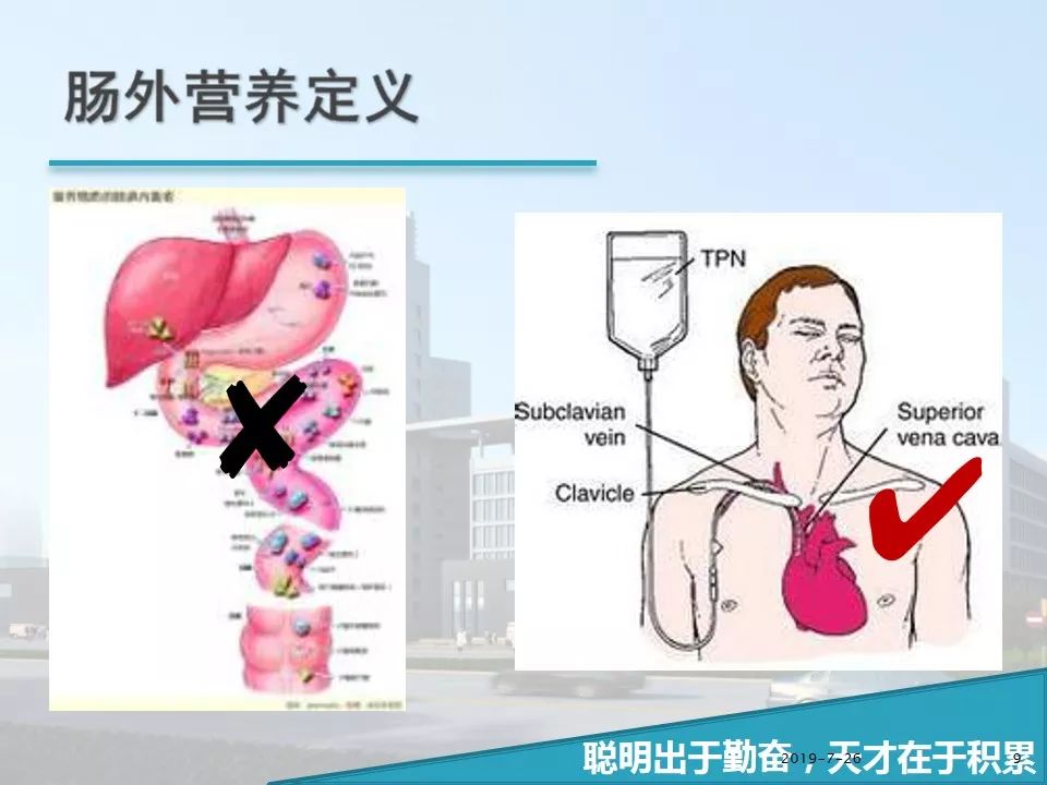 icu天天强调肠内营养,肠外营养这些事也得知晓!