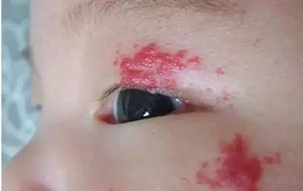                    月嫂总结那些被新手妈妈问过一万遍的问题