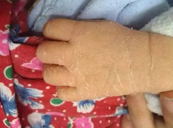                     月嫂总结那些被新手妈妈问过一万遍的问题