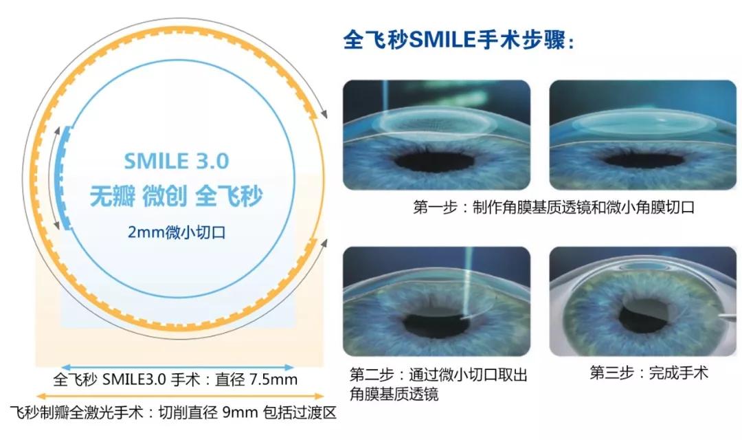 摘镜想要选择全飞秒先过这三关