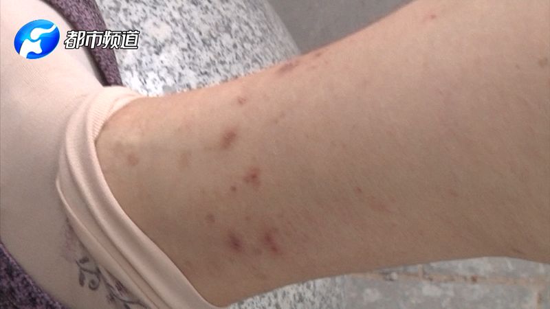 什么东西可以让人浑身发痒 b395ceffba9d4466a7f3de927fd8d291.jpeg