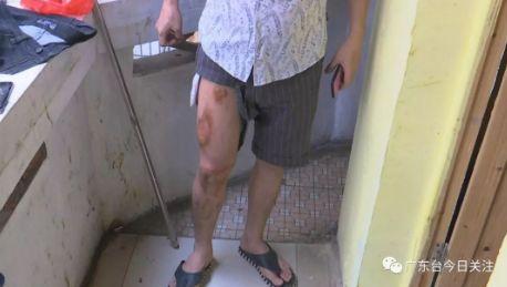 苹果手机放裤袋自燃!广州一男子被烫伤:我裤子都穿不了 申搏官网138