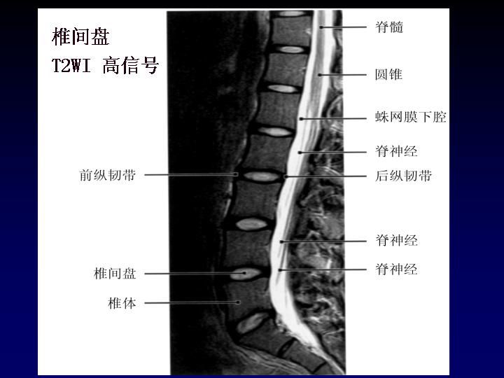 可提供腰椎管的矢状面,冠状面和轴位横断面上的影像.