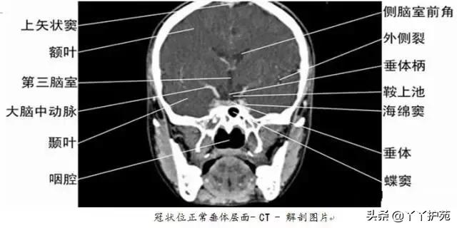 全身ct图谱收藏了吧