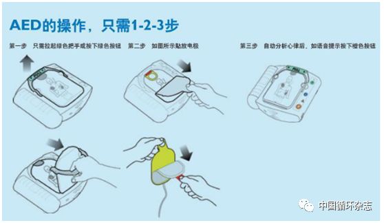 除颤仪的使用方法[技巧]word免费下载