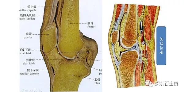 膝关节解剖示意图位于膝前区髌骨及其上方的股四头肌腱以及下方髌