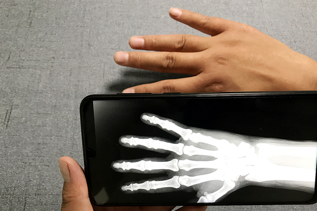 手机对准自己的手掌扫一下,手上的骨骼看得很清楚,太好玩了!