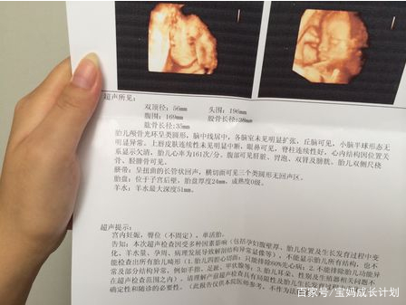 孕期四维彩超上的这几点,透露出胎儿的“小秘密”?你看的懂吗? 澳门美高梅4045com