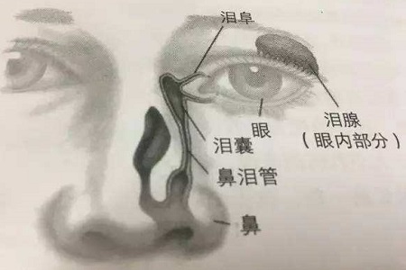 新生儿鼻泪管堵塞怎么办