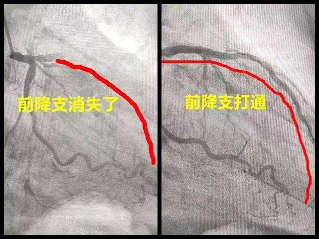 心脏急诊医生总结活命8条金律