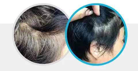 有白"发"不用染!一次性白"发"变黑,年轻健康