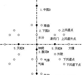 腹针疗法及16例常用处方