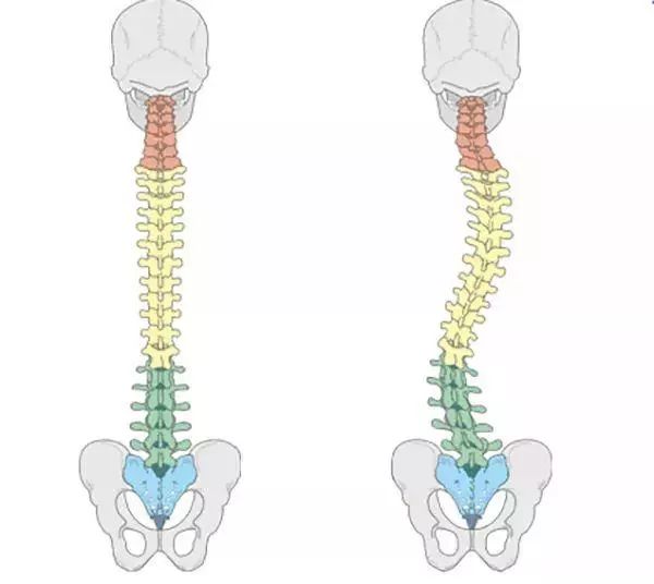 脊柱侧凸畸形特指在冠脊椎侧弯状位偏离.