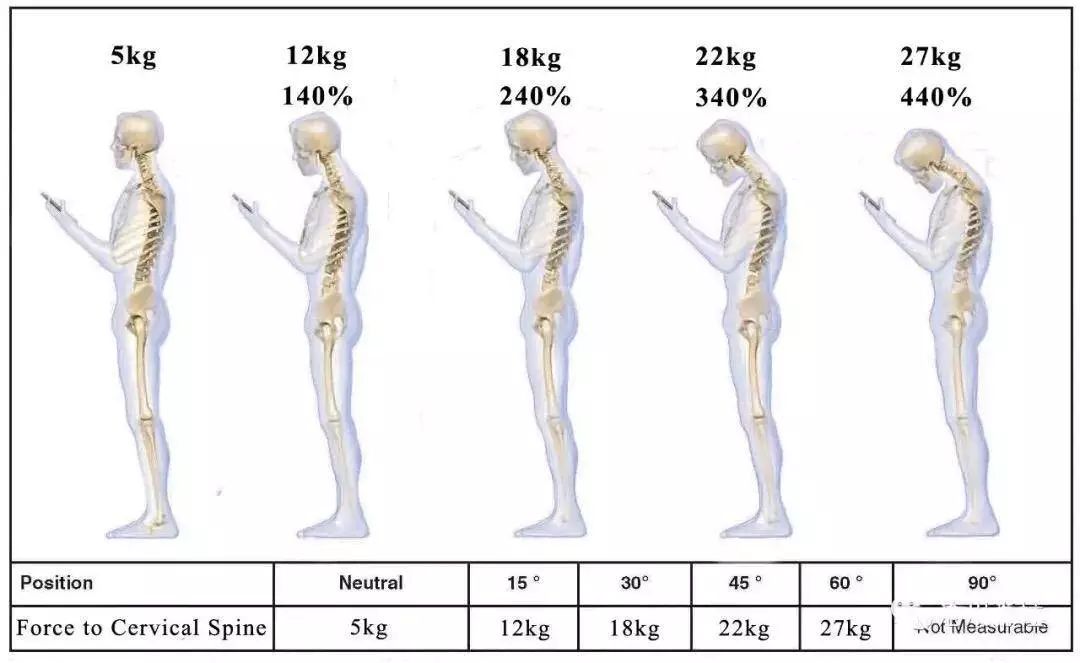 20-40岁青壮年6成有颈椎病,这个小动作最伤颈椎!