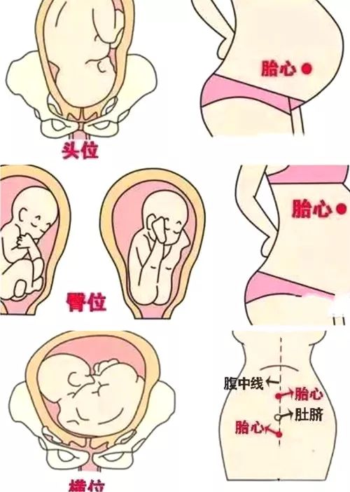 胎儿的胎位不同,那么胎心音的位置也不同怀孕期间,孕妇会比较好奇胎心