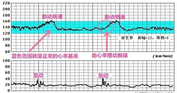                     胎儿心跳快？如果胎儿发出这种“受伤”信号，孕妇才需要注意