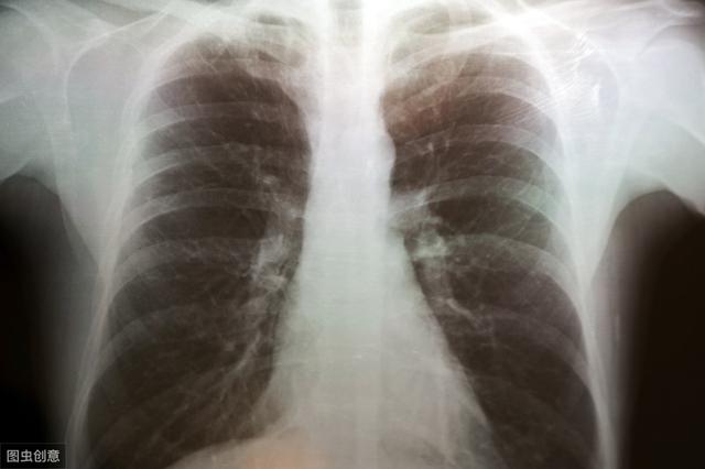如何预防肺气肿的发生 77824c0553714cf48e35da1c2ee3e630.jpeg