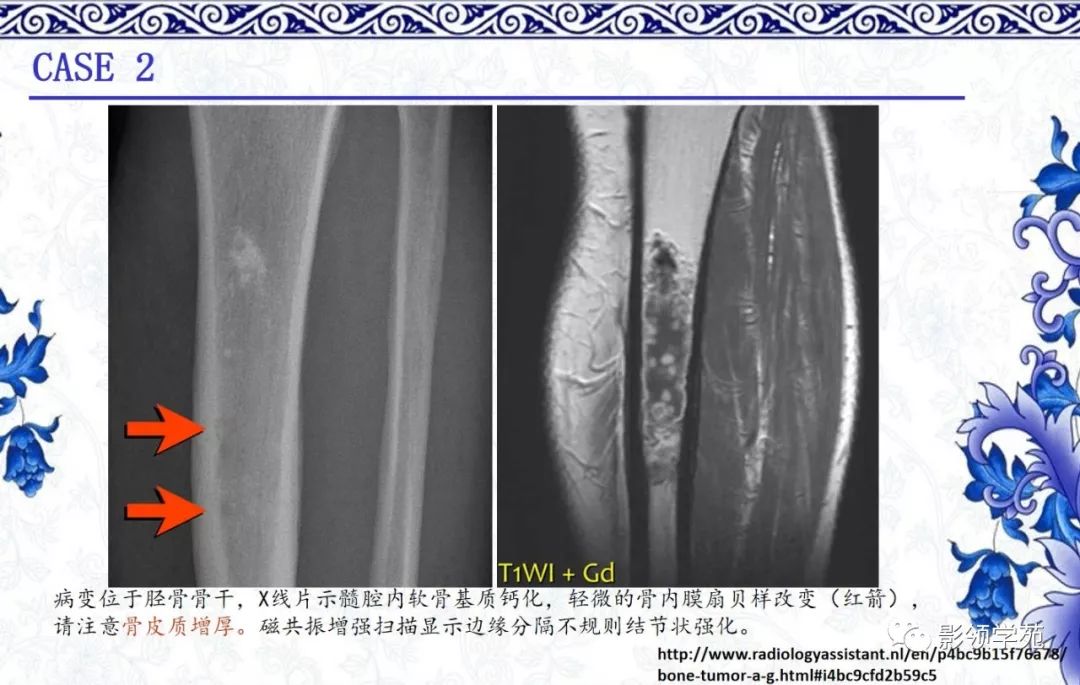 经典骨神联合视频课程免费领取