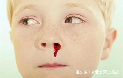                     原创            小孩经常流鼻血，有可能是5种原因所致！家长早了解可预防