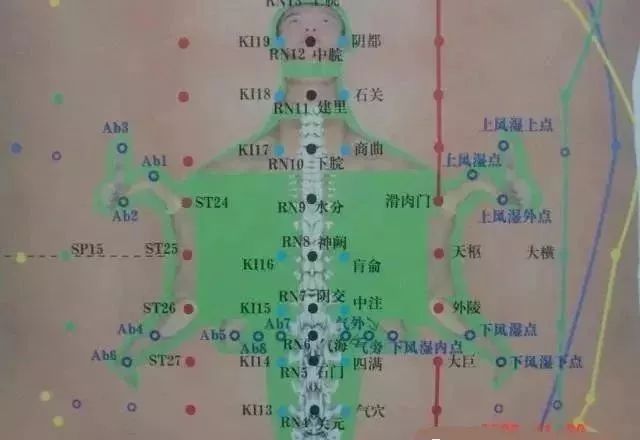 腹针疗法及16例常用处方