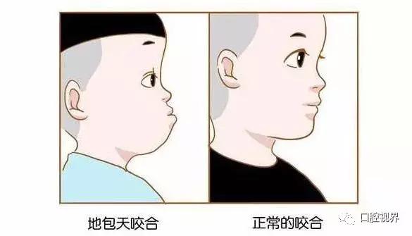 动画的3d特效,让地包天看着不明显,小编这里换个图再看看——作为专业