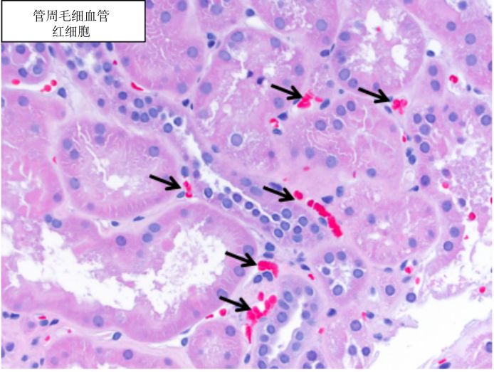 肾脏病理基础四肾脏血管