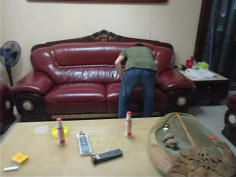 真皮被烟头烫了怎么办
