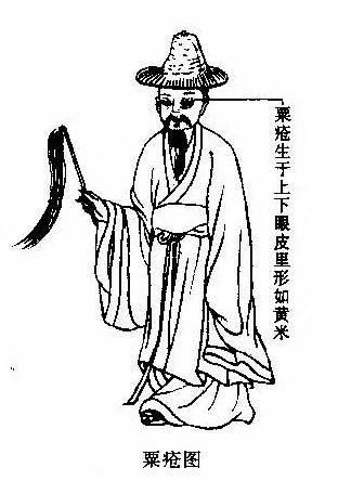 中医古籍中的人物画——《医宗金鉴》插图欣赏