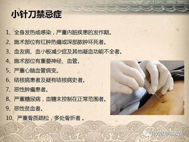 小针刀的起源发展史(图文版)