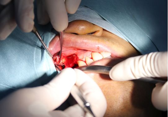 看牙有新去处啦罗湖医院春风路新院区开展首台口腔科种植牙手术