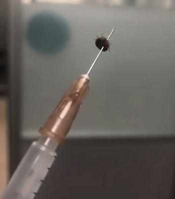 大连女子洗澡时,竟发现腰部长了粒“葡萄”!医生吓一跳……有致命危险 bwin代理