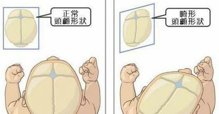                     宝宝长得丑萌丑萌的，都怪我没生好？这锅我可不背！