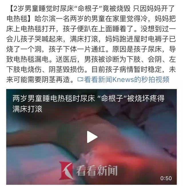                     烫伤撒盐、抹牙膏、涂酱油、浇二锅头？多少孩子被“偏方”坑惨了