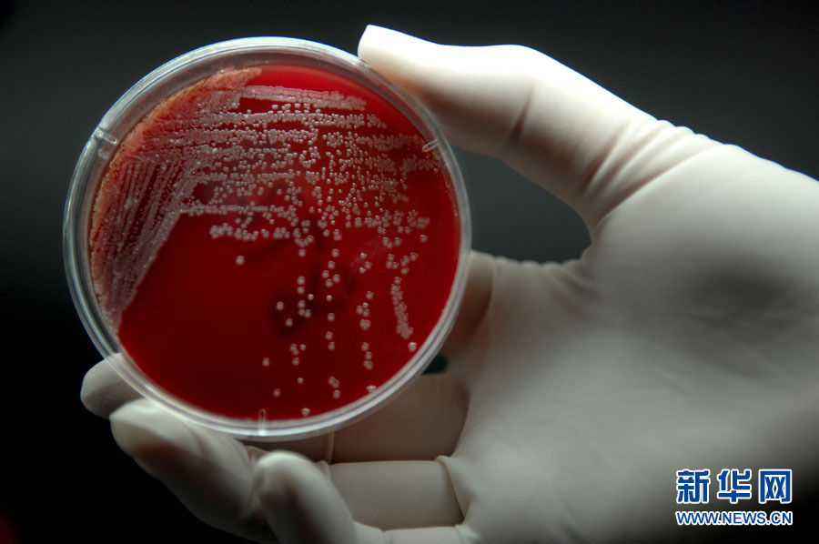 耐药的超级细菌正在医院中传播,其中耐药性肺炎克