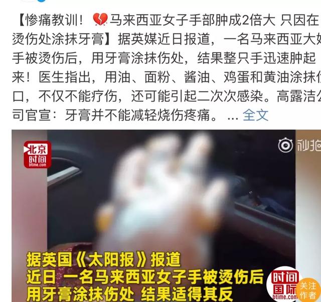                    烫伤撒盐、抹牙膏、涂酱油、浇二锅头？多少孩子被“偏方”坑惨了