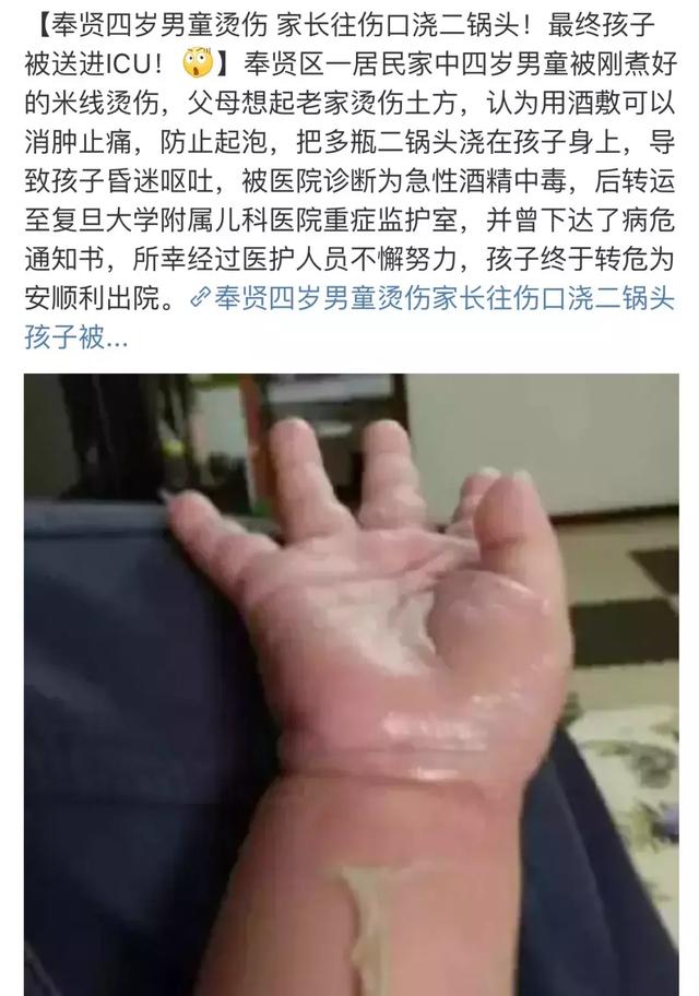                     烫伤撒盐、抹牙膏、涂酱油、浇二锅头？多少孩子被“偏方”坑惨了