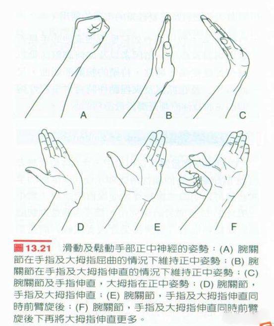 常见的引起腕管综合征的原因