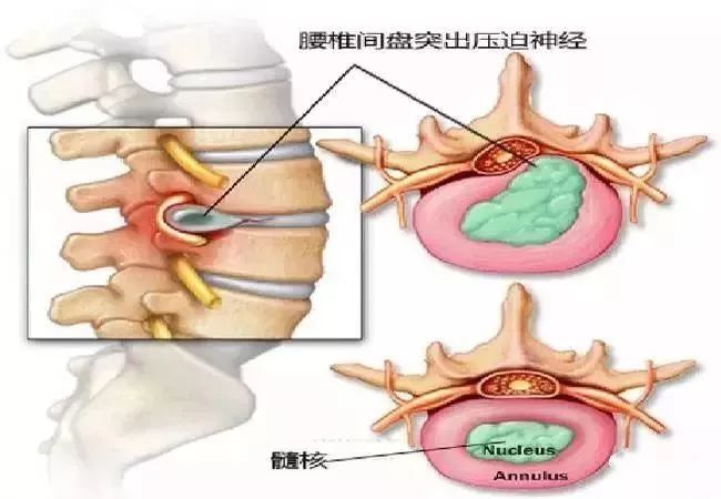 成语十什么如椎_成语故事简笔画(2)